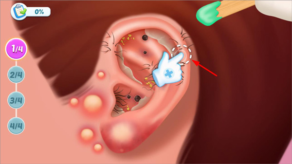 疯狂医院达什医生新手攻略图片1